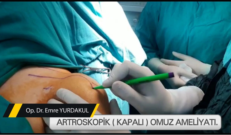 Omuz Hastalıkları